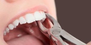 Interpretation of a dream about tooth extraction by hand