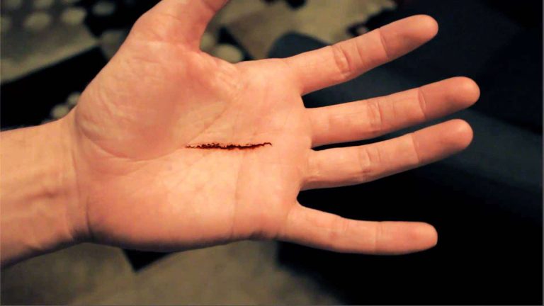 تفسير حلم قطع اليد