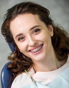 Interpretation ny nofy momba ny orthodontics