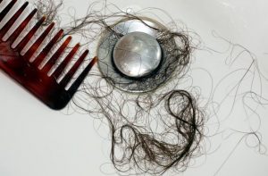 سقوط الشعر في المنام