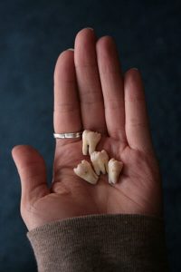 حلمت ان ضرسي طاح