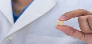 حلم نزع الضرس بدون ألم