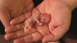 Interpretation of a dream about abortion and seeing blood