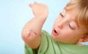 الجروح في المنام