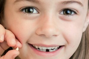 سقوط السن الأمامي في الحلم