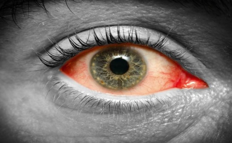 رؤية الحاسد في المنام