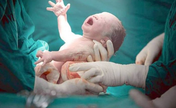 Naturlig fødsel finder sted på hospitalet i detaljer - hemmeligheder om drømmetydning