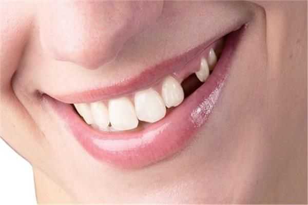  حلم وقوع الأسنان للعزباء - اسرار تفسير الاحلام