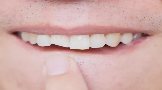 इब्न सिरिन द्वारा दांत तोड़ने के सपने की व्याख्या
