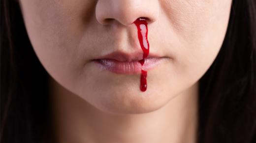 Zistite viac o interpretácii krvácania z nosa vo sne podľa Ibn Sirina