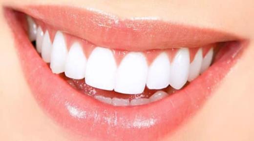 Saznajte o tumačenju sna o bijelim zubima od Ibn Sirina