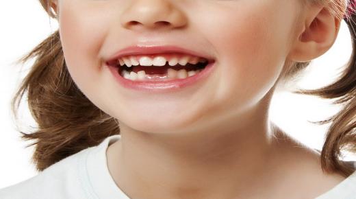 أهم 100 تفسير لسقوط الأسنان السفلية في المنام لابن سيرين