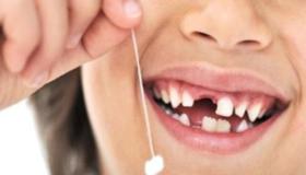 تفسير حلم سقوط الأسنان في المنام لابن سيرين