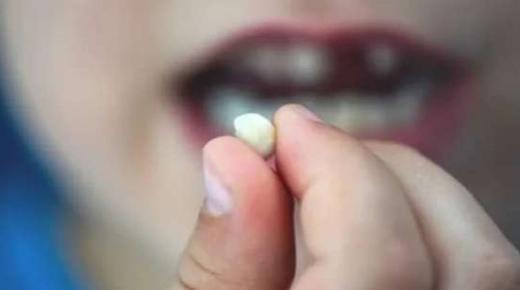 बिना खून के दांत गिरने के सपने की इब्न सिरिन की व्याख्या