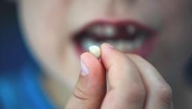 Իմացեք Իբն Սիրինի ատամի քայքայման մասին երազի մեկնաբանությունը